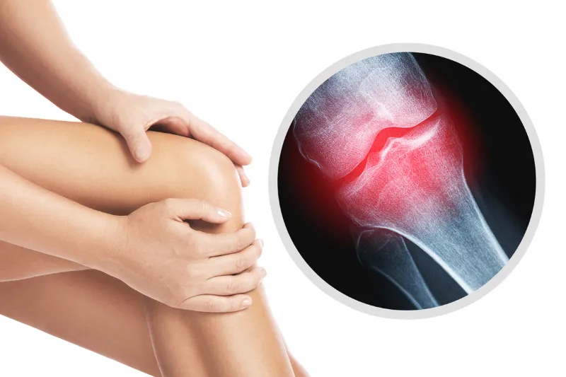 วิธีดูแลกระดูกหลังวัย 40 เพื่อชีวิตที่ยืนยาวและคล่องตัว