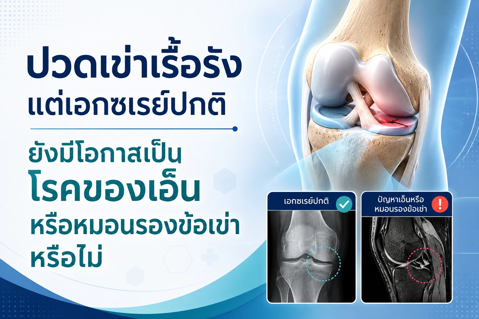 ปวดเข่าเรื้อรังแต่เอกซเรย์ปกติ ยังมีโอกาสเป็นโรคของเอ็นหรือหมอนรองข้อเข่าหรือไม่